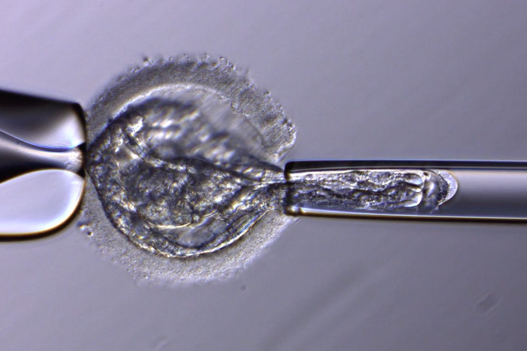 PGT-A / PGT-SR（着床前遺伝学的検査）